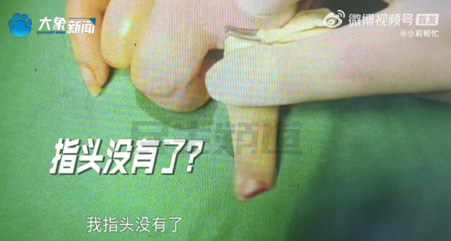 孕妇吃火锅拉了一下凳子手指被切断，当事人：怀孕做不了手术，指头彻底没了，店长：我们没什么责任