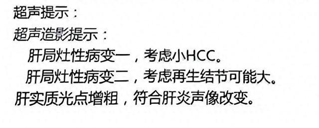 男子肝癌诊断存争议卫健委介入
